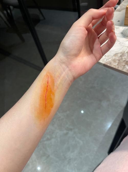 经常被猫抓伤怎么办/经常被猫咪抓伤-第1张图片 经常被猫抓伤怎么办/经常被猫咪抓伤-第1张图片