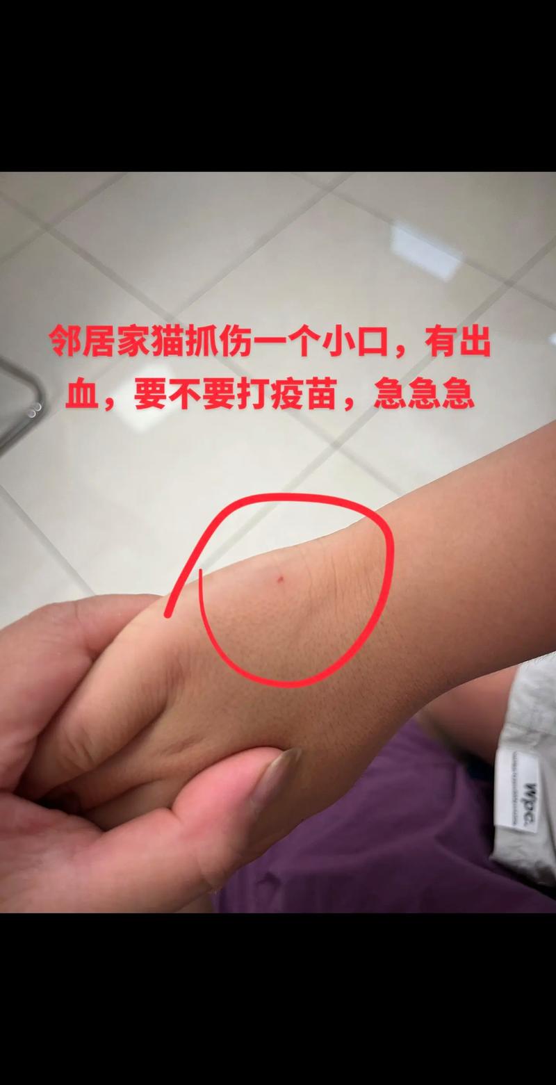 经常被猫抓伤怎么办/经常被猫咪抓伤-第4张图片 经常被猫抓伤怎么办/经常被猫咪抓伤-第4张图片