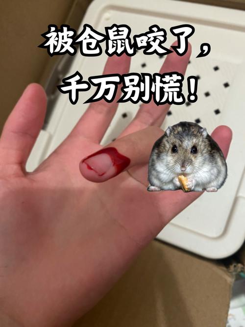 仓鼠会不会咬人,仓鼠会不会咬人,咬人会不会中毒-第6张图片 仓鼠会不会咬人,仓鼠会不会咬人,咬人会不会中毒-第6张图片