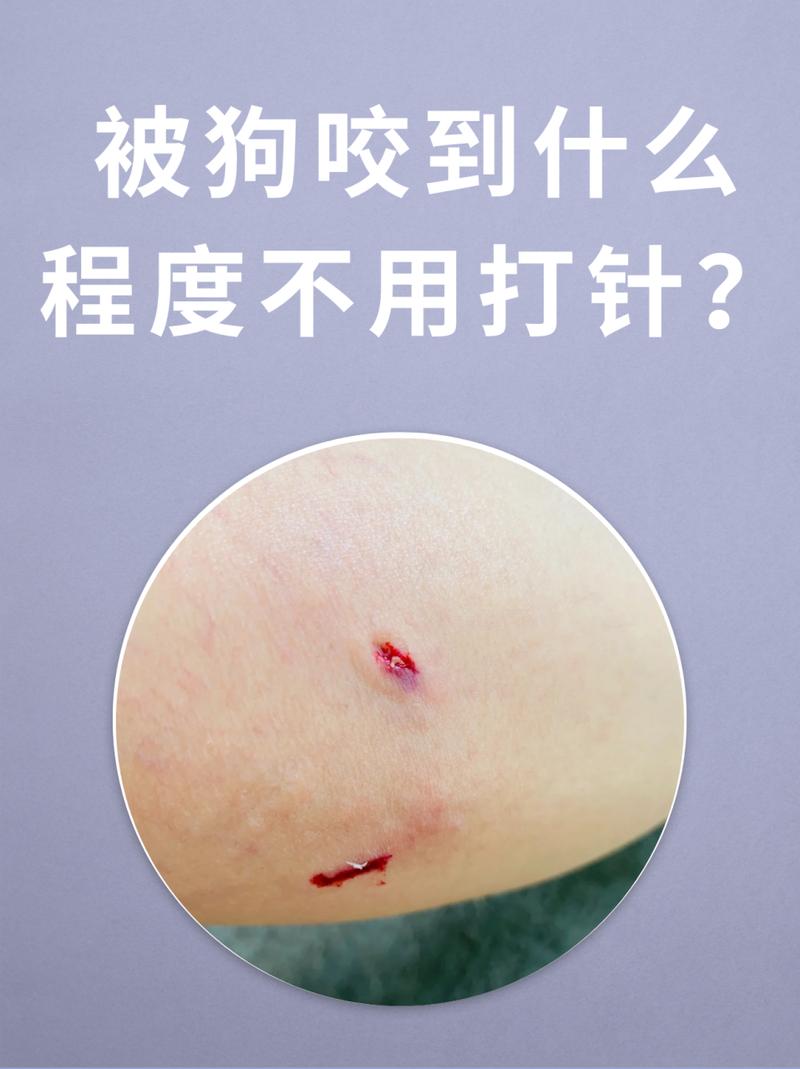 狗狗会被蚊子咬吗/狗狗会被蚊子叮么?-第9张图片 狗狗会被蚊子咬吗/狗狗会被蚊子叮么?-第9张图片