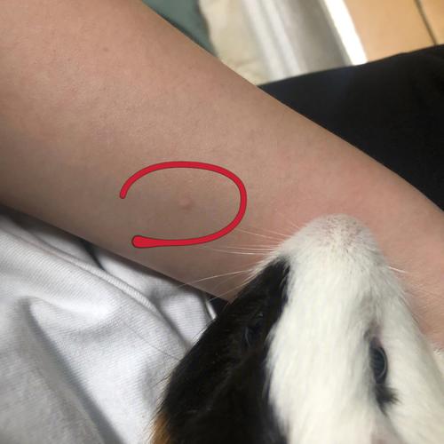 被荷兰猪咬了需不需要打针/被荷兰猪咬伤了怎么办-第2张图片 被荷兰猪咬了需不需要打针/被荷兰猪咬伤了怎么办-第2张图片