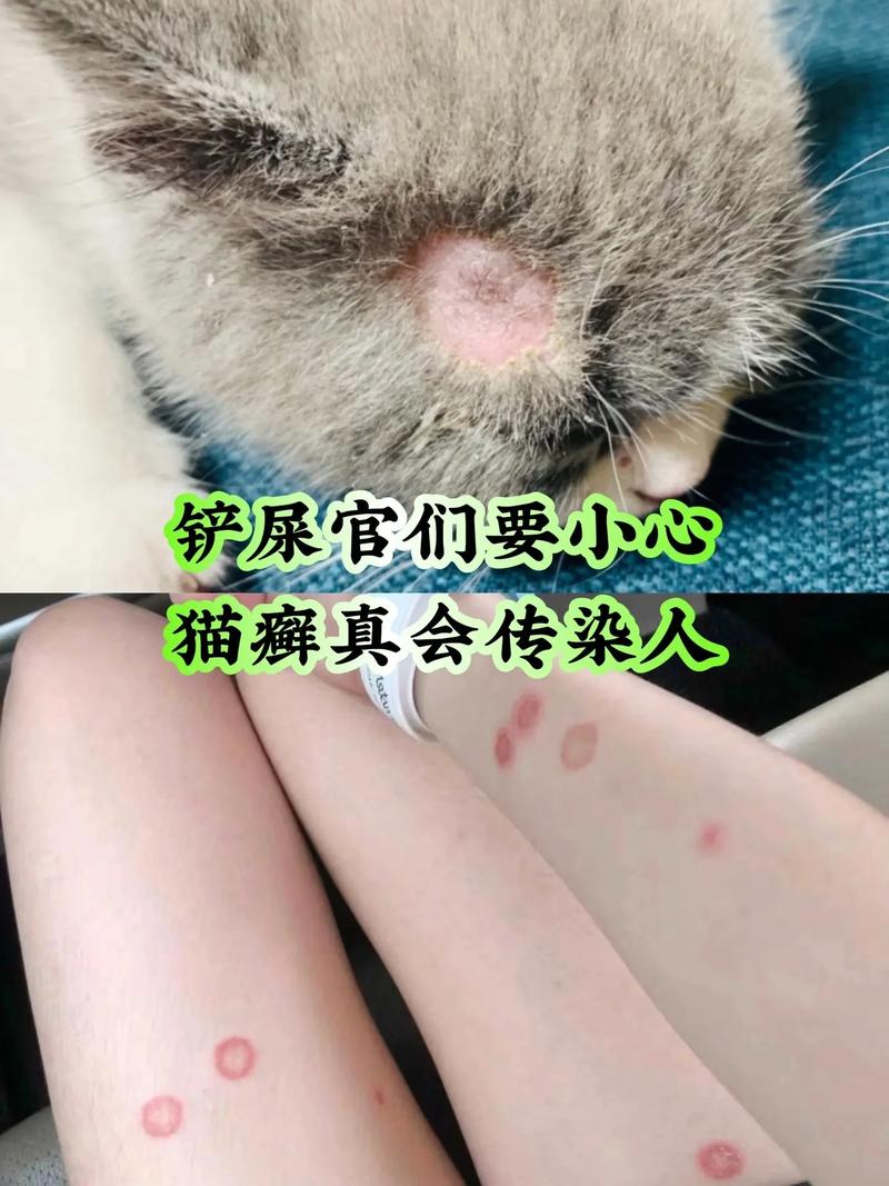 猫藓会人传人吗/猫藓会人传人吗?-第3张图片 猫藓会人传人吗/猫藓会人传人吗?-第3张图片