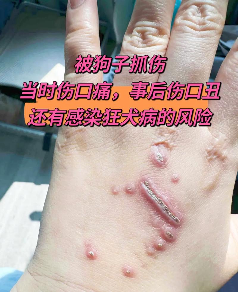 作为消费者“狂犬病的早期症状”你不能不知道-第4张图片 作为消费者“狂犬病的早期症状”你不能不知道-第4张图片