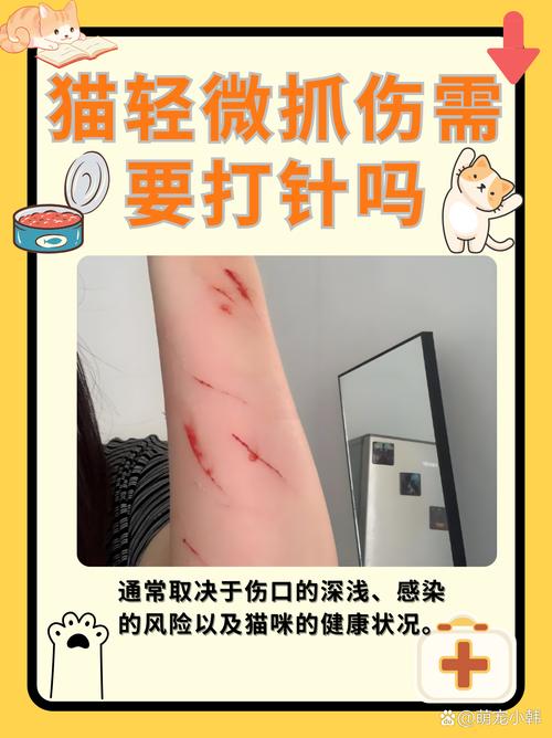 被猫咪抓出血了怎么办-被猫咪抓了出血了会不会有事-第5张图片 被猫咪抓出血了怎么办-被猫咪抓了出血了会不会有事-第5张图片