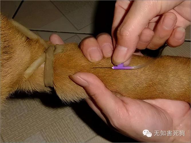解析“留置针怎么拔”你不知道的事-第4张图片 解析“留置针怎么拔”你不知道的事-第4张图片