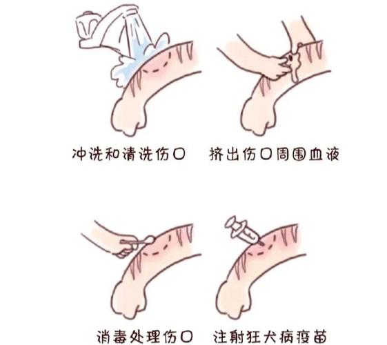被自家宠物狗咬了怎么办,被自家宠物狗咬伤了需要打疫苗吗-第5张图片 被自家宠物狗咬了怎么办,被自家宠物狗咬伤了需要打疫苗吗-第5张图片