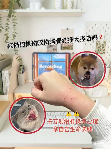 被猫咬破皮了需要打针吗,被猫咬破皮怎么办有必要打针-第7张图片 被猫咬破皮了需要打针吗,被猫咬破皮怎么办有必要打针-第7张图片