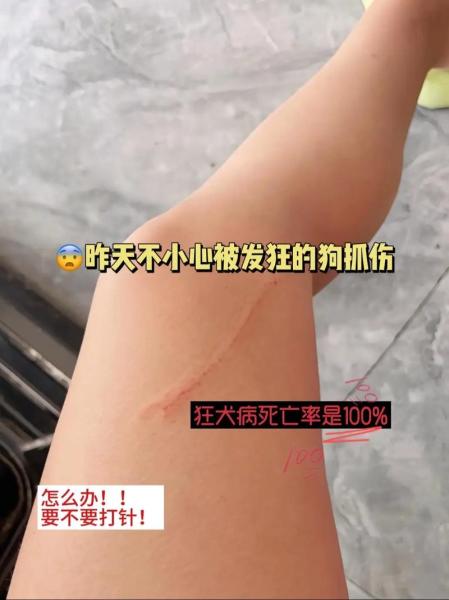 被自己家的狗狗抓了一下/被自己家的狗狗抓了一下有事吗-第1张图片 被自己家的狗狗抓了一下/被自己家的狗狗抓了一下有事吗-第1张图片