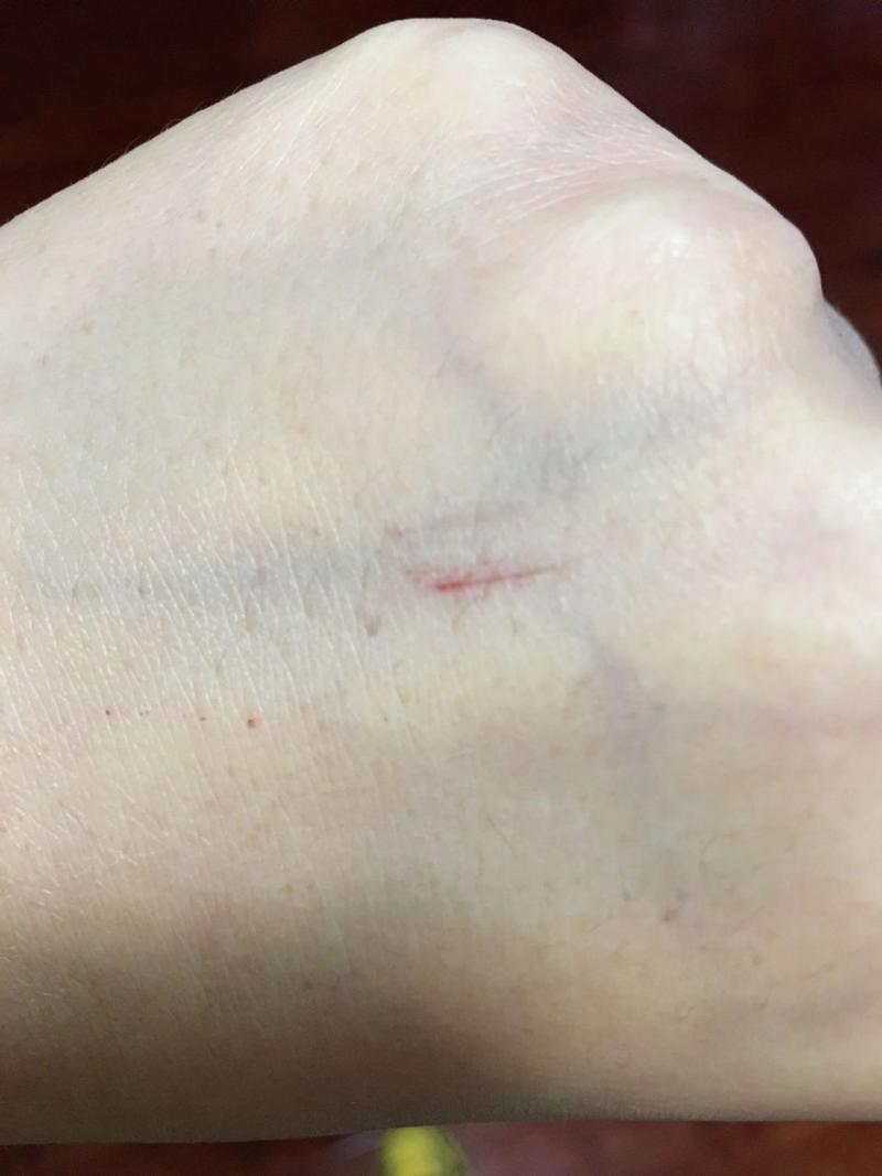 被自己家的狗狗抓了一下/被自己家的狗狗抓了一下有事吗-第2张图片 被自己家的狗狗抓了一下/被自己家的狗狗抓了一下有事吗-第2张图片