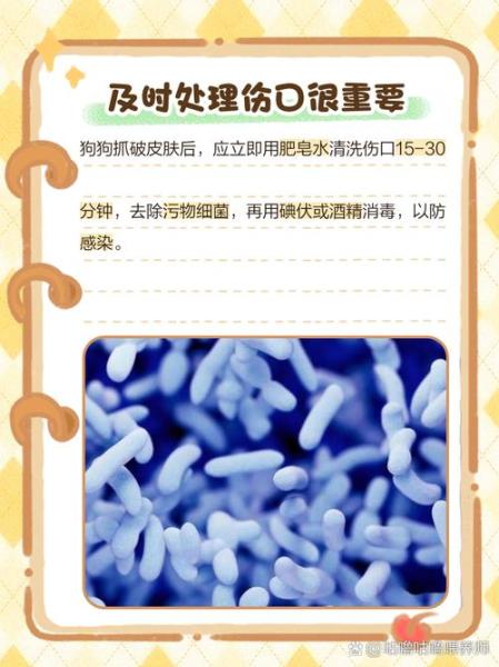 被自己家的狗狗抓了一下/被自己家的狗狗抓了一下有事吗-第3张图片 被自己家的狗狗抓了一下/被自己家的狗狗抓了一下有事吗-第3张图片