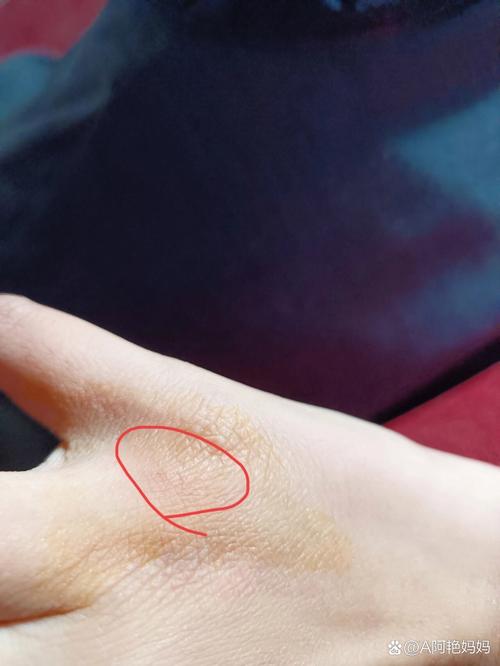 被自己家的狗狗抓了一下/被自己家的狗狗抓了一下有事吗-第6张图片 被自己家的狗狗抓了一下/被自己家的狗狗抓了一下有事吗-第6张图片
