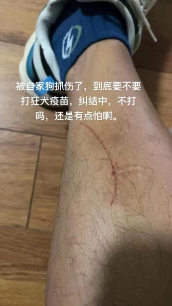 被自己家的狗狗抓了一下/被自己家的狗狗抓了一下有事吗-第8张图片 被自己家的狗狗抓了一下/被自己家的狗狗抓了一下有事吗-第8张图片