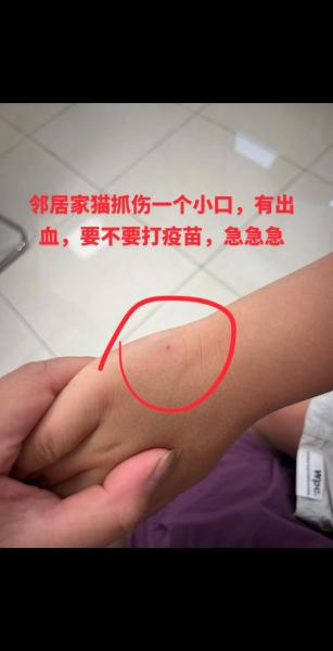 被自己家猫咪抓出血了/被自己家猫咪抓了轻微出血了-第2张图片 被自己家猫咪抓出血了/被自己家猫咪抓了轻微出血了-第2张图片