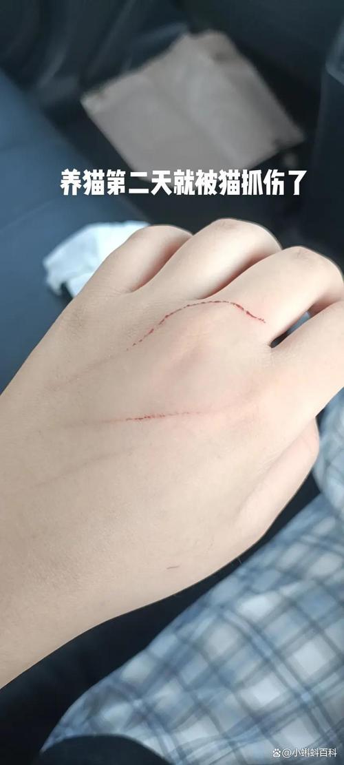 被自己家猫咪抓出血了/被自己家猫咪抓了轻微出血了-第3张图片 被自己家猫咪抓出血了/被自己家猫咪抓了轻微出血了-第3张图片