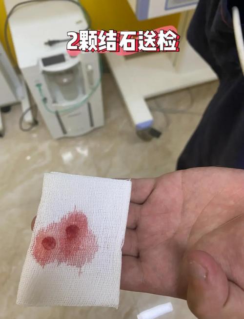 解析“猫咪做手术大概多少钱”你不知道的事-第7张图片 解析“猫咪做手术大概多少钱”你不知道的事-第7张图片